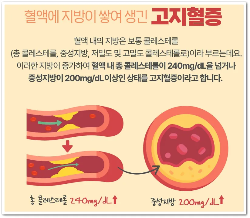고지혈증 식단 2026: 좋은 음식 vs 피해야 할 음식 총정리