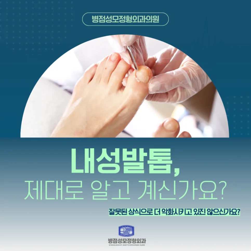 내성발톱 수술 없이 교정하는 방법 2026: 오니코클립 집중 분석