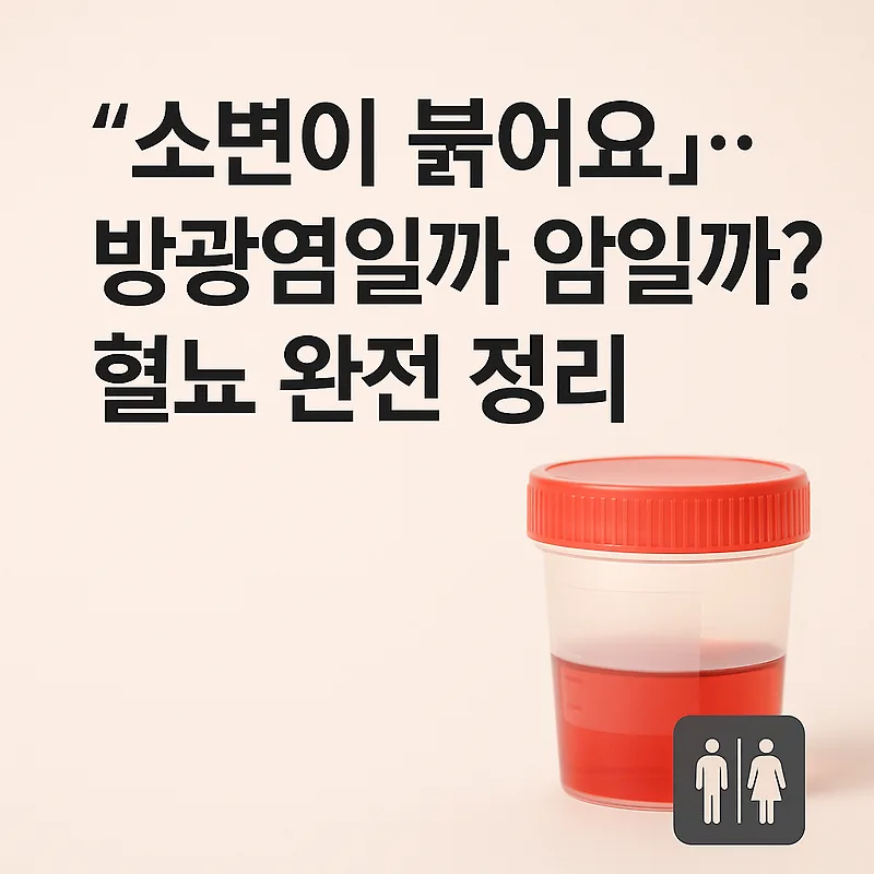 혈뇨 원인과 증상: 방광염 vs 암, 2026년 전문가가 총정리