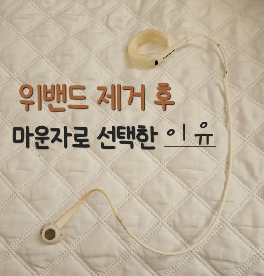 위밴드 vs 마운자로: 14년 경험자가 2026년에 선택하는 이유는?