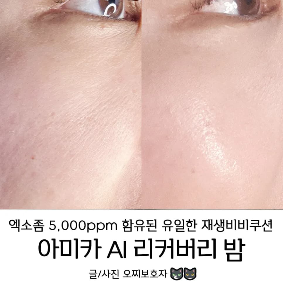 바르고 자는 재생비비 쿠션, 아미카 AI 리커버리 밤 효과 2026