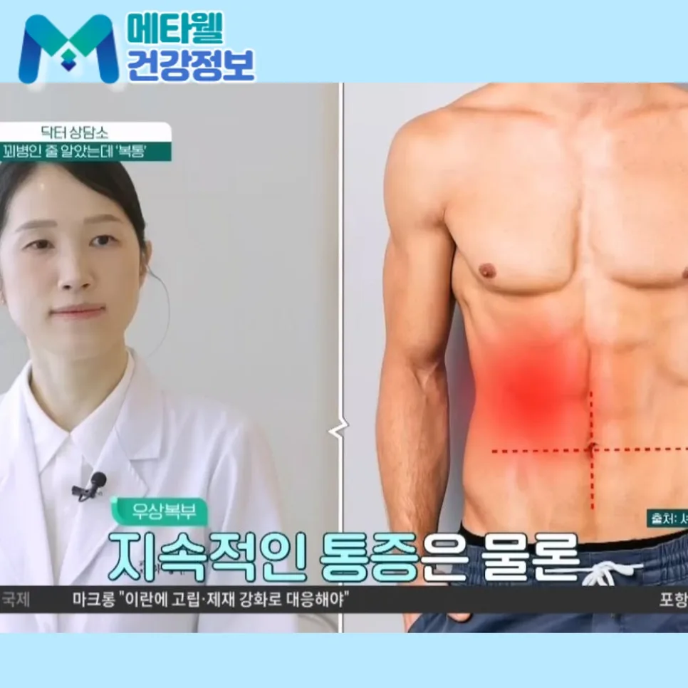 여자 배꼽 통증 원인 5가지와 응급 신호 2026년 총정리